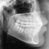 Radiologia Odontológica em Formosa - GO
